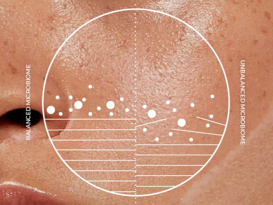 The skin microbiome